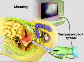 Название: узи простаты.jpg
Просмотров: 483
Размер: 23.5 Кб